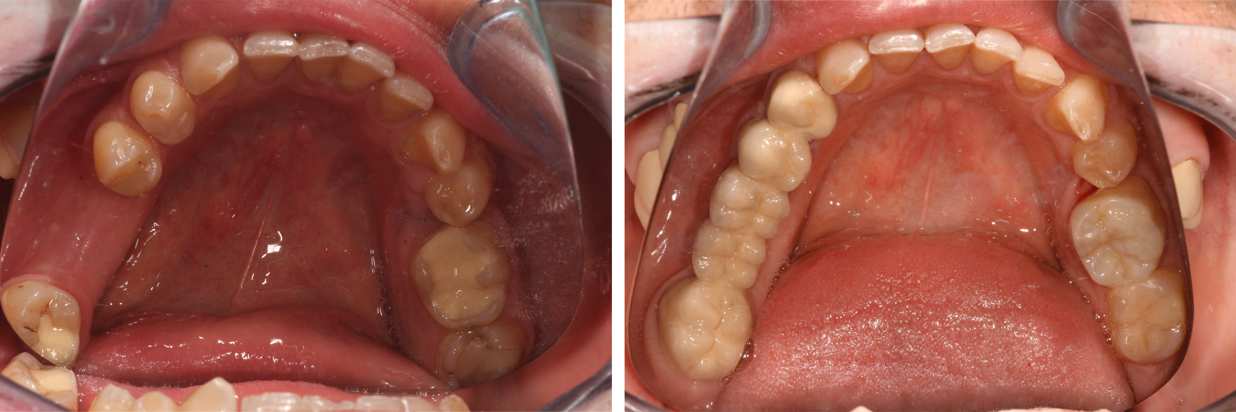MesterDent Munkáink