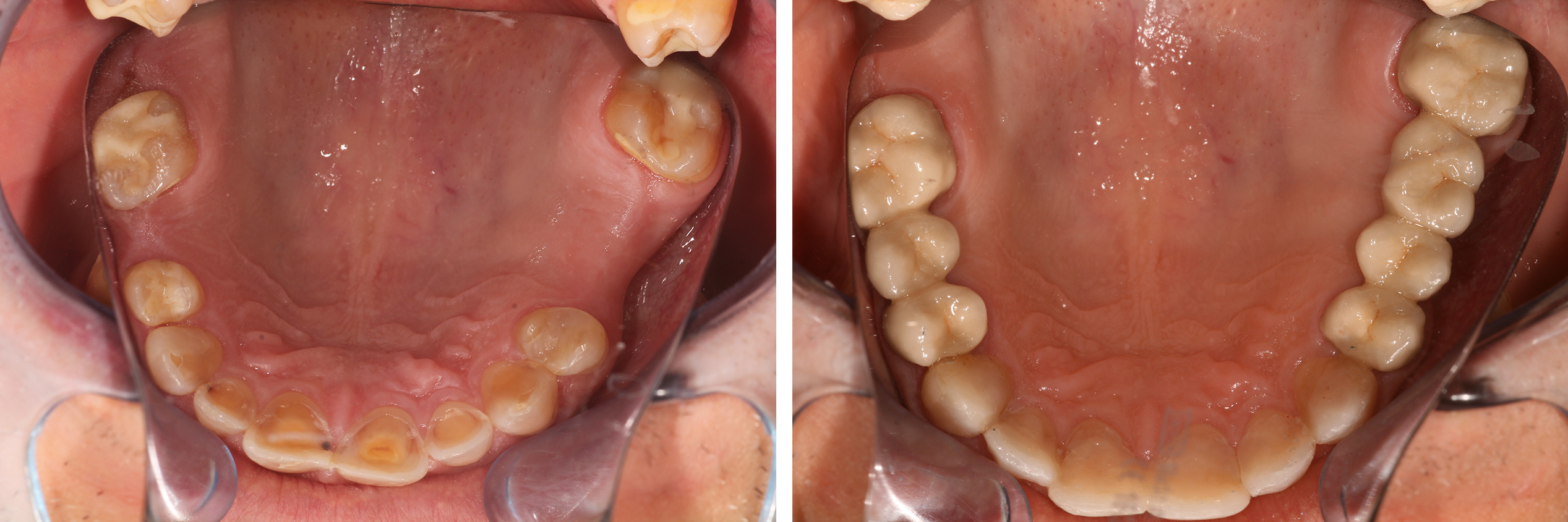 MesterDent Munkáink