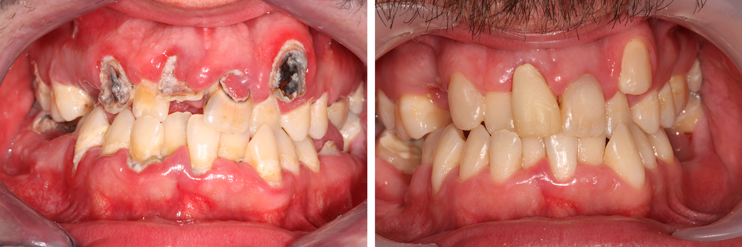 MesterDent Munkáink