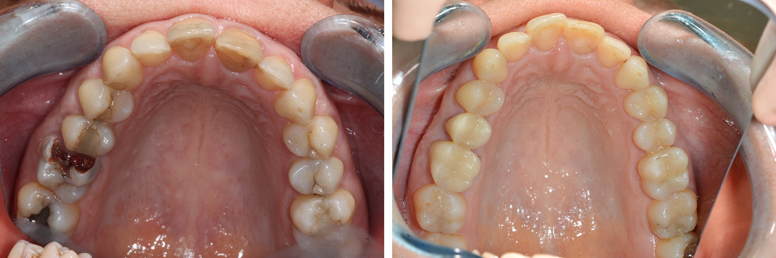 MesterDent Munkáink